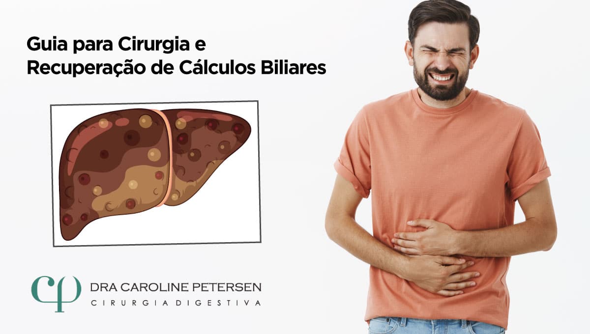 cirurgia-calculo-biliar