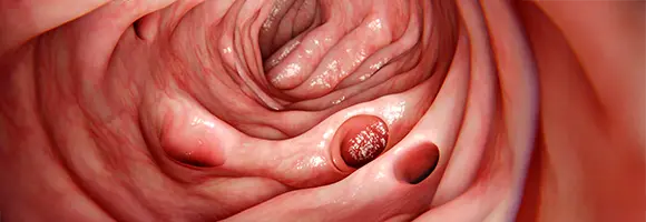 Cirurgia do Aparelho Digestivo